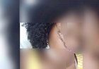 Menina leva golpe de facão no rosto ao defender amiga de agressão do namorado em Trindade