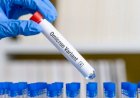 Brasil registra dois casos positivos confirmados da variante ômicron