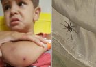 Em Goiás: Criança de 2 anos é internada após picada de aranha