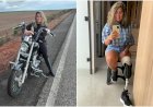 Mulher denuncia que teve parte da perna e dedos amputados após infecção generalizada causada por lipoaspiração