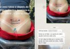 Em Goiás: Mulher tatua nome do namorado, termina três dias depois e pede ajuda ao tatuador para remover