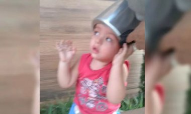 Em Goiás: Menino de 2 anos fica com a cabeça presa em panela de pressão