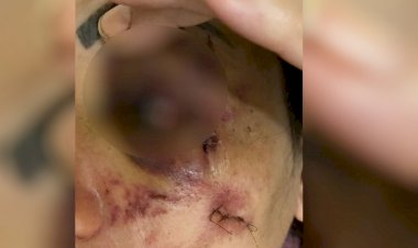 Homem é suspeito de agredir a mulher a pauladas e a abandonar seminua em frente a hospital de Rio Verde