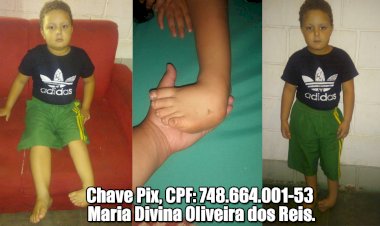 Solidariedade: Mãe pede ajuda para cirurgia do filho que possui doença congênita no pé