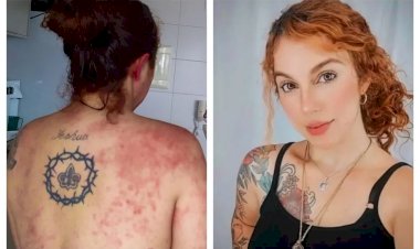 Em Goiás: Maquiadora com doença crônica luta na Justiça para conseguir medicamento pelo SUS