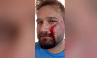 Médico denuncia que foi agredido com capacete por pai de paciente ao negar atestado de 3 dias: ‘Fiquei atordoado’