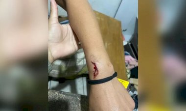 Homem é preso suspeito de agredir a ex com mordida e marteladas, em Jaraguá