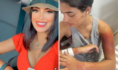 Câmeras de segurança podem ter registrado agressões de namorado a estudante de direito que bebeu cerveja 'sem a permissão dele', diz polícia