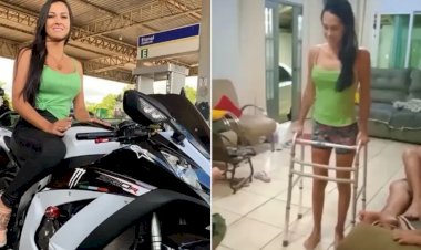 Enfermeira atropelada ao impedir agressão contra mulher comemora ao andar pela 1ª vez após acidente: ‘Sensação incrível’
