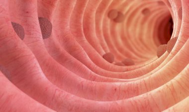 Alimentos que você deve evitar para reduzir risco de câncer de intestino