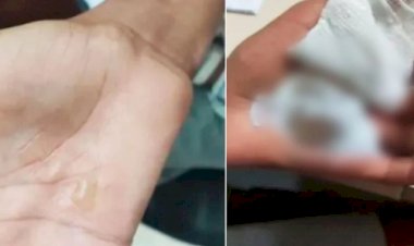 Em Goiás: Mãe e madrasta são indiciadas por torturar menino com colher quente