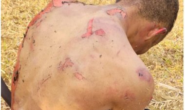 Em Goiás: ''Pena máxima e indenização'', diz advogado da família de homem que teve corpo queimado