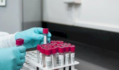 Mulher que desenvolveu doença em estudo clínico receberá pensão de laboratório, em Goiás