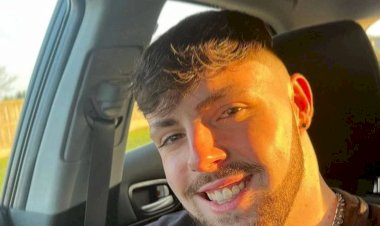 Homem fica com o rosto deformado ao ignorar proibição de sexo após transplante capilar; veja foto