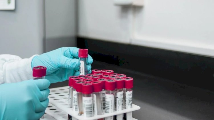 Mulher que desenvolveu doença em estudo clínico receberá pensão de laboratório, em Goiás
