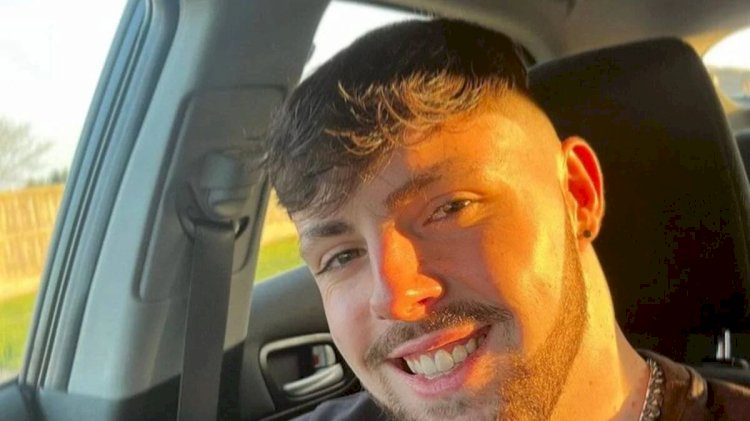 Homem fica com o rosto deformado ao ignorar proibição de sexo após transplante capilar; veja foto